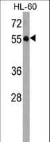 KLHL3 Antibody (aa207-234)