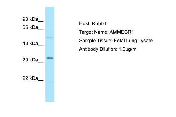 AMMECR1 Antibody (C-Terminus)