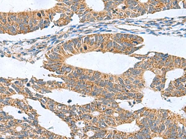 CLEC1B / CLEC-2 Antibody