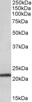 IHC-plus™ TMEM205 Antibody (aa137-146)