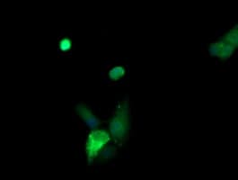 KLK8 / Kallikrein 8 Antibody (clone OTI1A10)