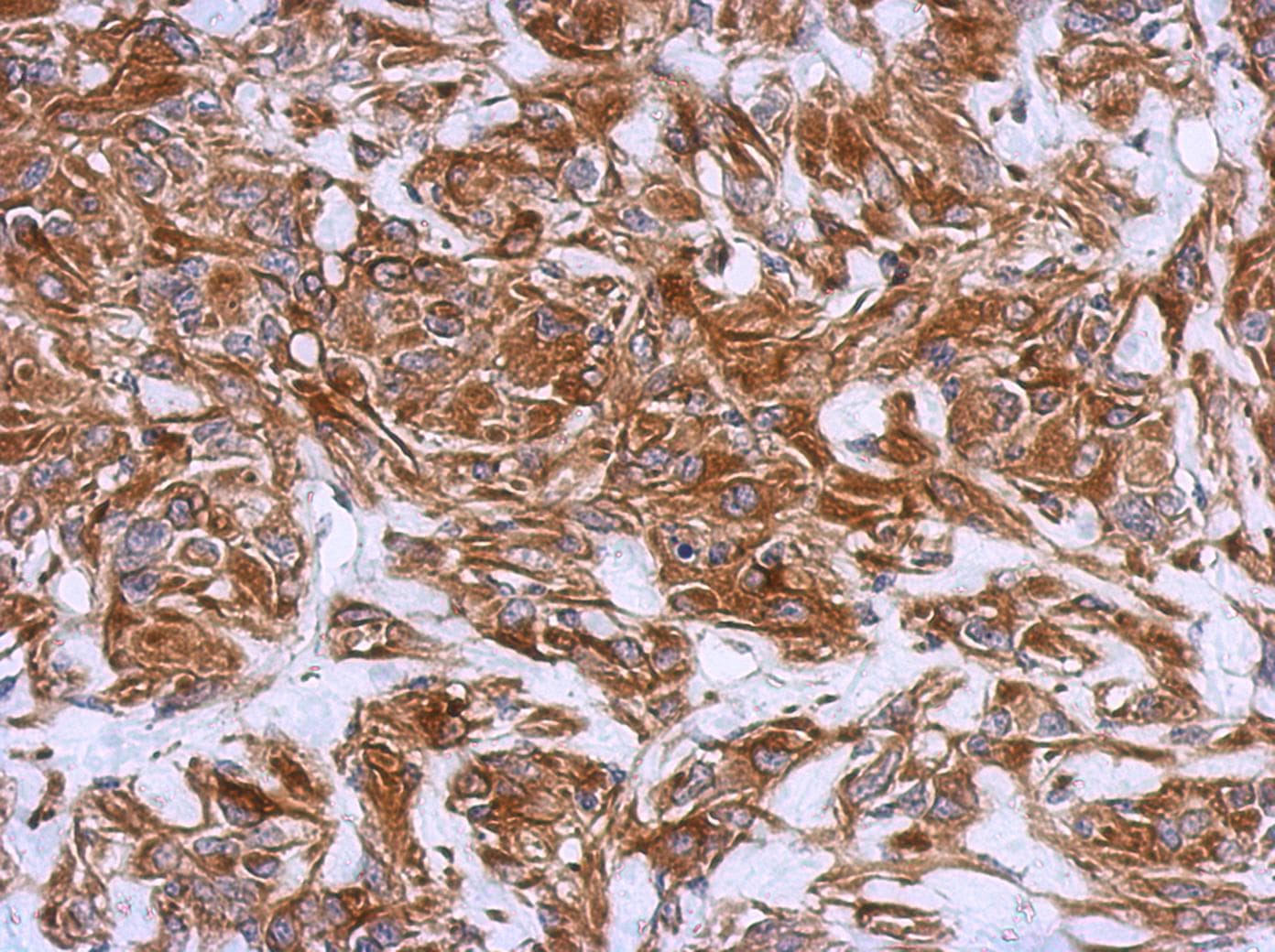 IHC-plus™ Polyclonal Rabbit anti-Human STAT2 Antibody (C-Terminus, IHC, WB)