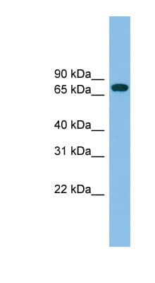 Polyclonal Rabbit anti-Human GBP2 Antibody (aa143-192, WB)