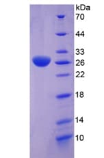 Human CLU / Clusterin Protein (Recombinant His)