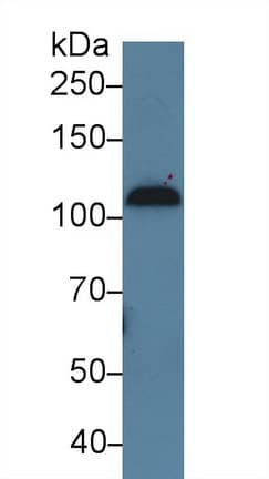 Complement C7 Antibody (aa122-456, FITC)