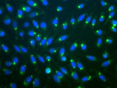 Polyclonal Rabbit anti-Human UBC / Ubiquitin C Antibody (IHC, IF, WB)