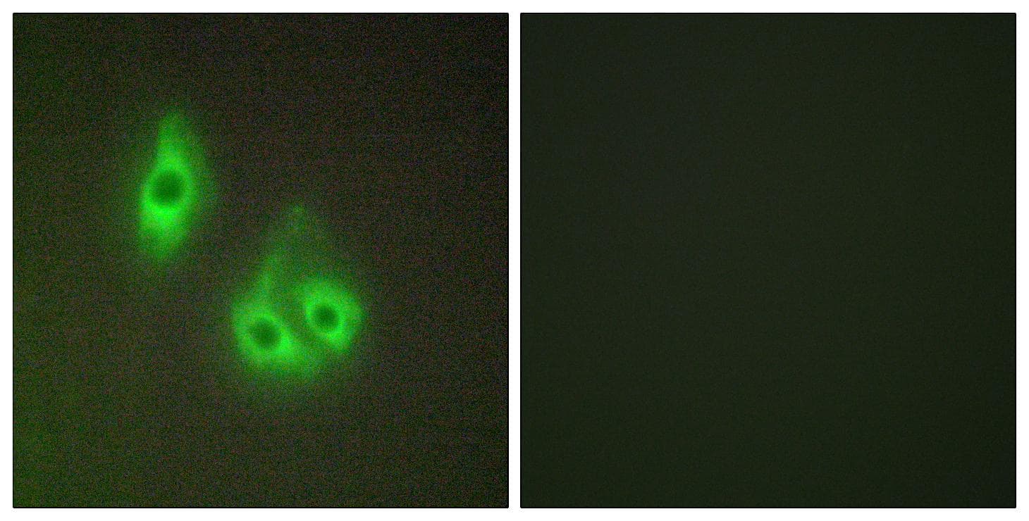 Polyclonal Rabbit anti-Human LAMA3 / Laminin Alpha 3 Antibody (IHC, IF)