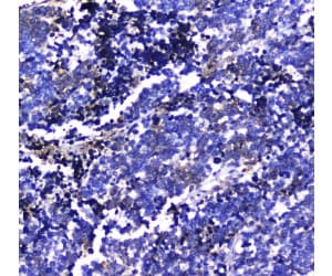 Polyclonal Rabbit anti-Human MAC-2-BP / LGALS3BP Antibody (IHC, WB)