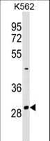 Polyclonal Rabbit anti-Human NRIP2 Antibody (aa91-119, WB)