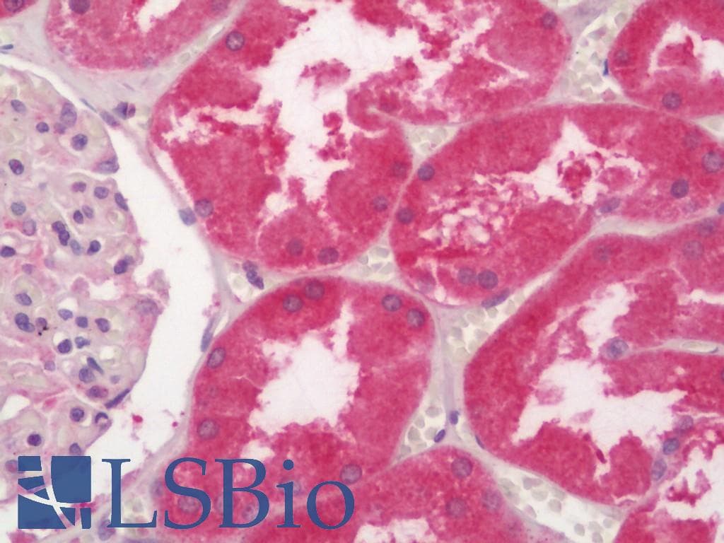 IHC-plus™ Polyclonal Rabbit anti-Human TIGAR Antibody (aa220-270, IHC)