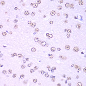 Polyclonal Rabbit anti-Human NONO / P54NRB Antibody (IHC, IF, WB)