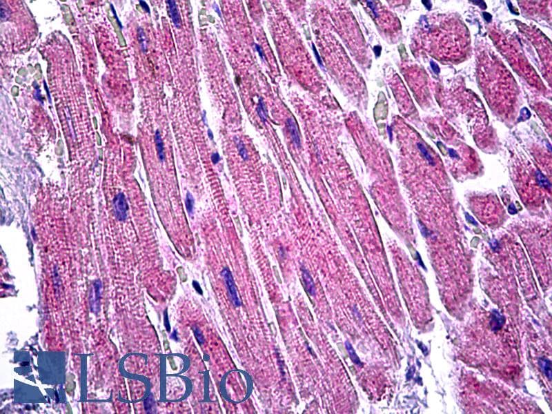 IHC-plus™ VCL / Vinculin Antibody (aa786-835)