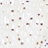Histone H2B Antibody