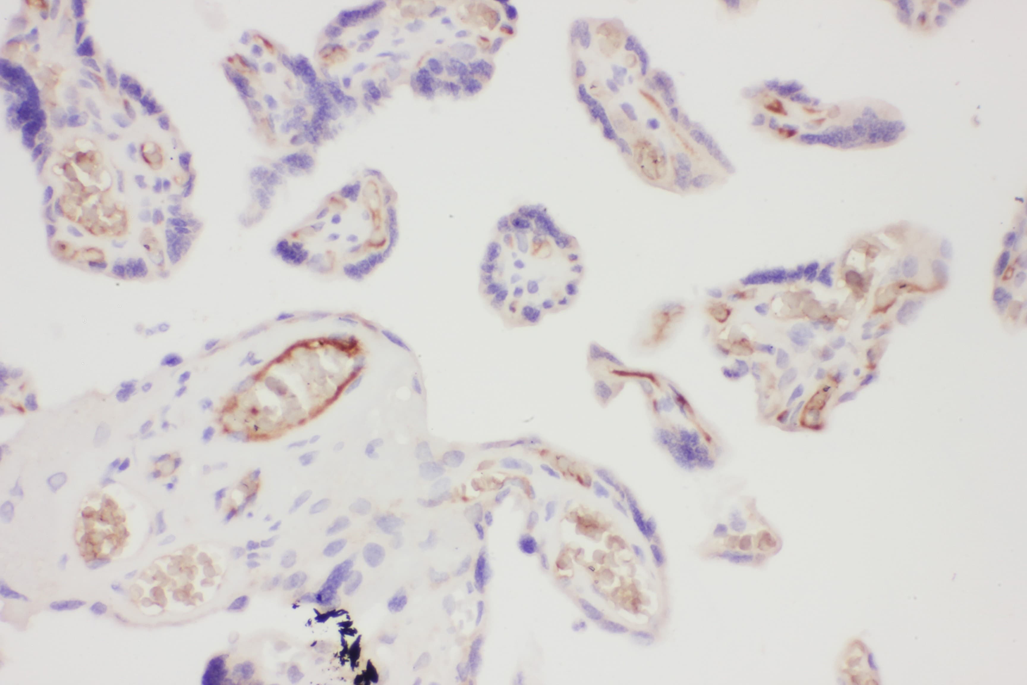 Polyclonal Rabbit anti-Human ITGB1 / Integrin Beta 1 / CD29 Antibody (aa527-728, IHC, WB)