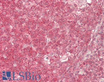 IHC-plus™ STXBP2 Antibody