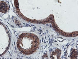 Monoclonal Mouse anti-Human FDFT1 / Squalene Synthase Antibody (clone OTI2F10, IHC, IF, WB)