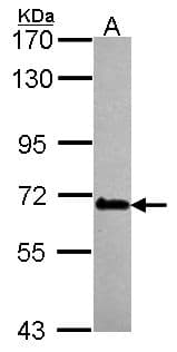 DDX56 Antibody (aa201-393)