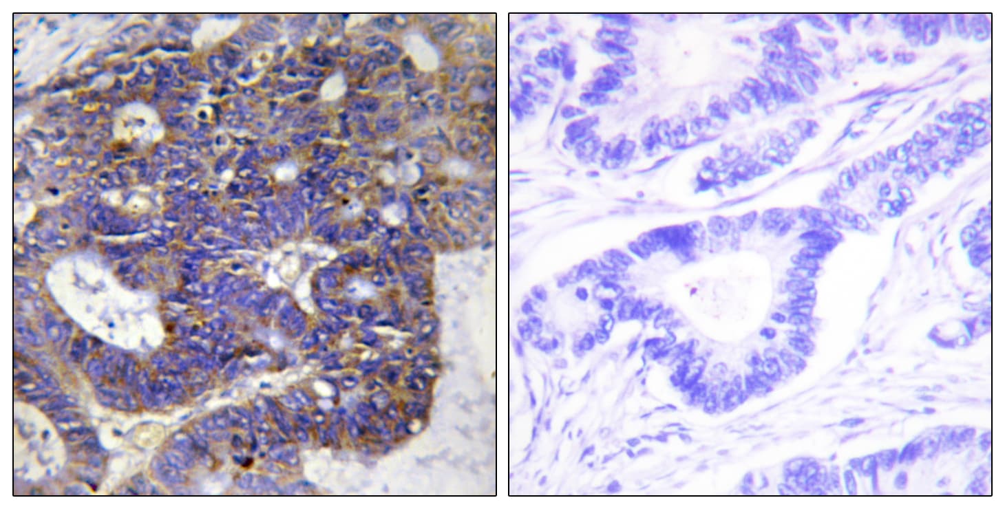 COL4A2 / Collagen IV Alpha2 Antibody (aa151-200)