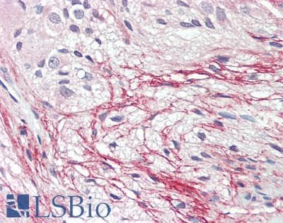 IHC-plus™ B4GAT1 / B3GNT1 Antibody