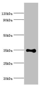 RAD51L3 / RAD51D Antibody (aa1-328)