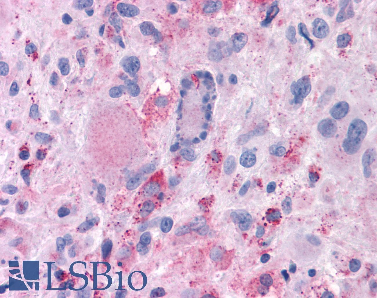 PathPlus™ MRGPRX2 / MRGX2 Antibody (Extracellular Domain)