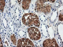 ACY1 / Aminoacylase 1 Antibody (clone OTI1A12)