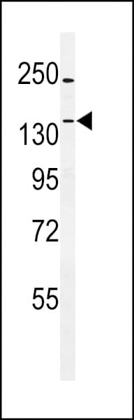 TTBK1 Antibody (aa230-258)