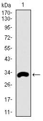 FcERI / Fc Epsilon RI Antibody (aa42-103, clone 1F2A9)