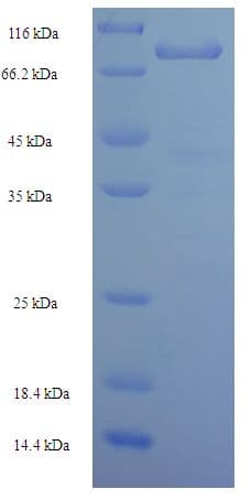 Human LRRN1 Protein (Recombinant His-SUMO)