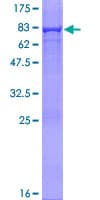 Human ADSL / Adenylosuccinate Lyase Protein (Recombinant GST)