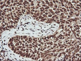 FAK / Focal Adhesion Kinase Antibody (clone OTI4D11)