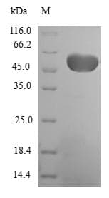 Human EF1B / EEF1B2 Protein (Recombinant GST, N-terminus)