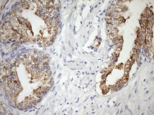 CSF2RB / CD131 Antibody (clone OTI7G6)