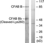 CFB / Complement Factor B Antibody (aa241-290)