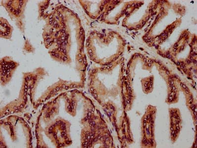 FBXO10 Antibody
