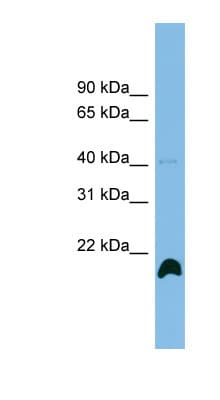 PPIH / Cyclophilin H Antibody (aa35-84)