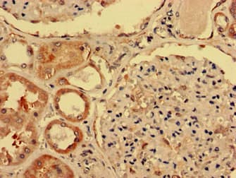 IGHD Antibody