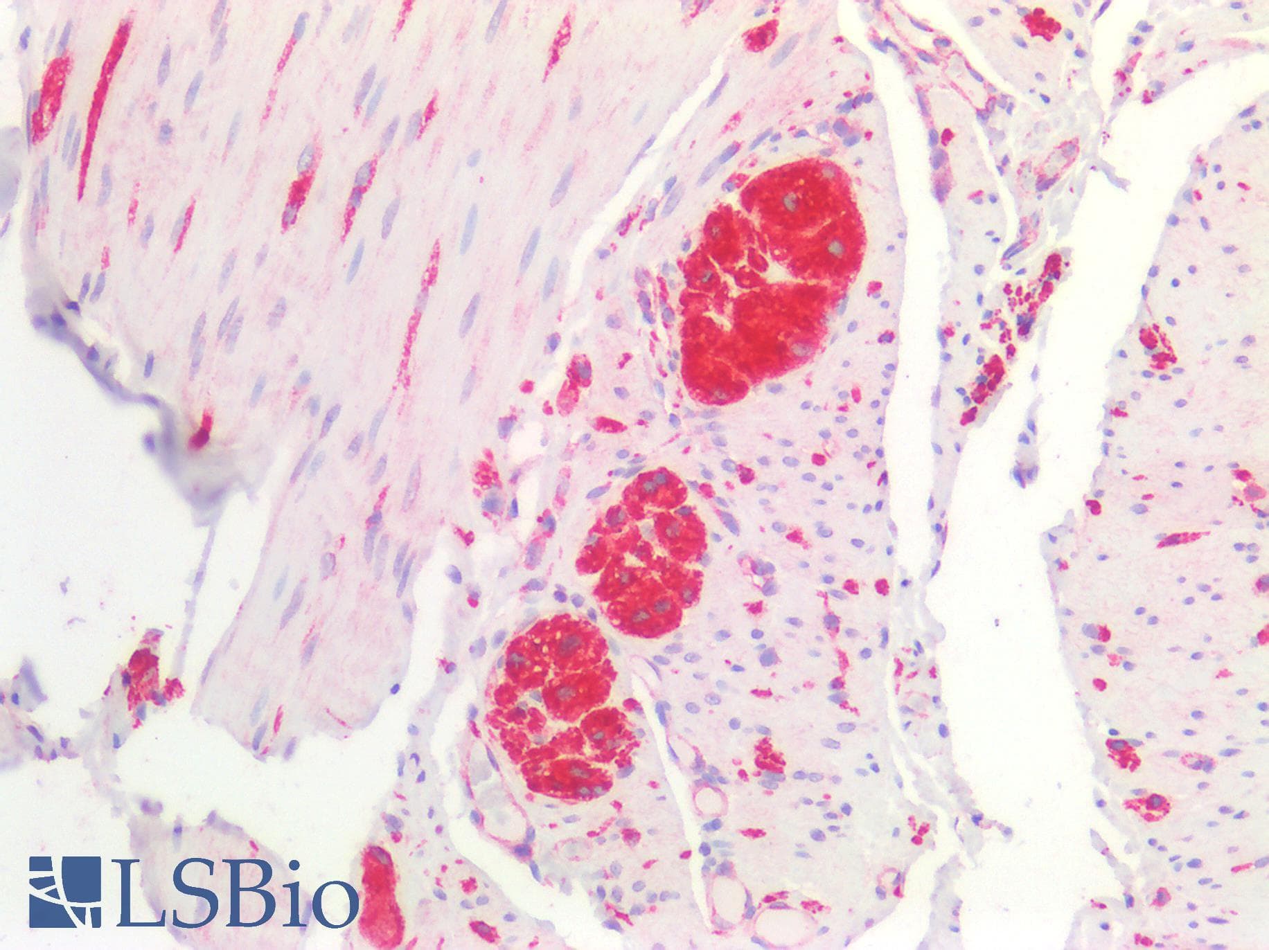 IHC-plus™ Proenkephalin / PENK Antibody