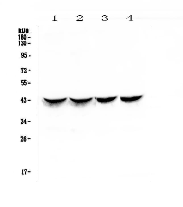 TNNT2 / CTNT Antibody