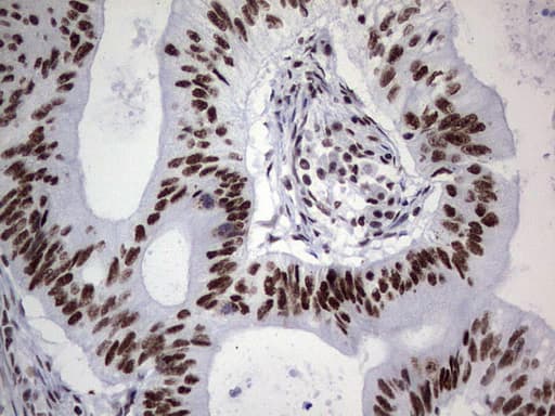 Monoclonal Mouse anti-Human PPP1R8 / Rnase E Antibody (clone OTI4E5, aa1-225, IHC, WB)