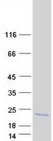 Human IFNA21 / Interferon Alpha 21 Protein (Recombinant Myc-DDK (Flag))