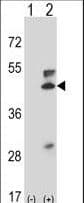 MAP2K5 / MEK5 Antibody (aa385-412)