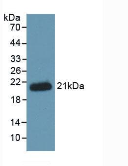 HFE2 / Hemojuvelin Antibody