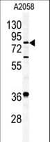 Polyclonal Rabbit anti-Human APH / APEH Antibody (aa174-204, WB)
