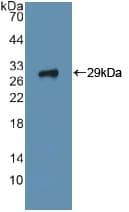 ITGA2 / CD49b Antibody (aa170-361)
