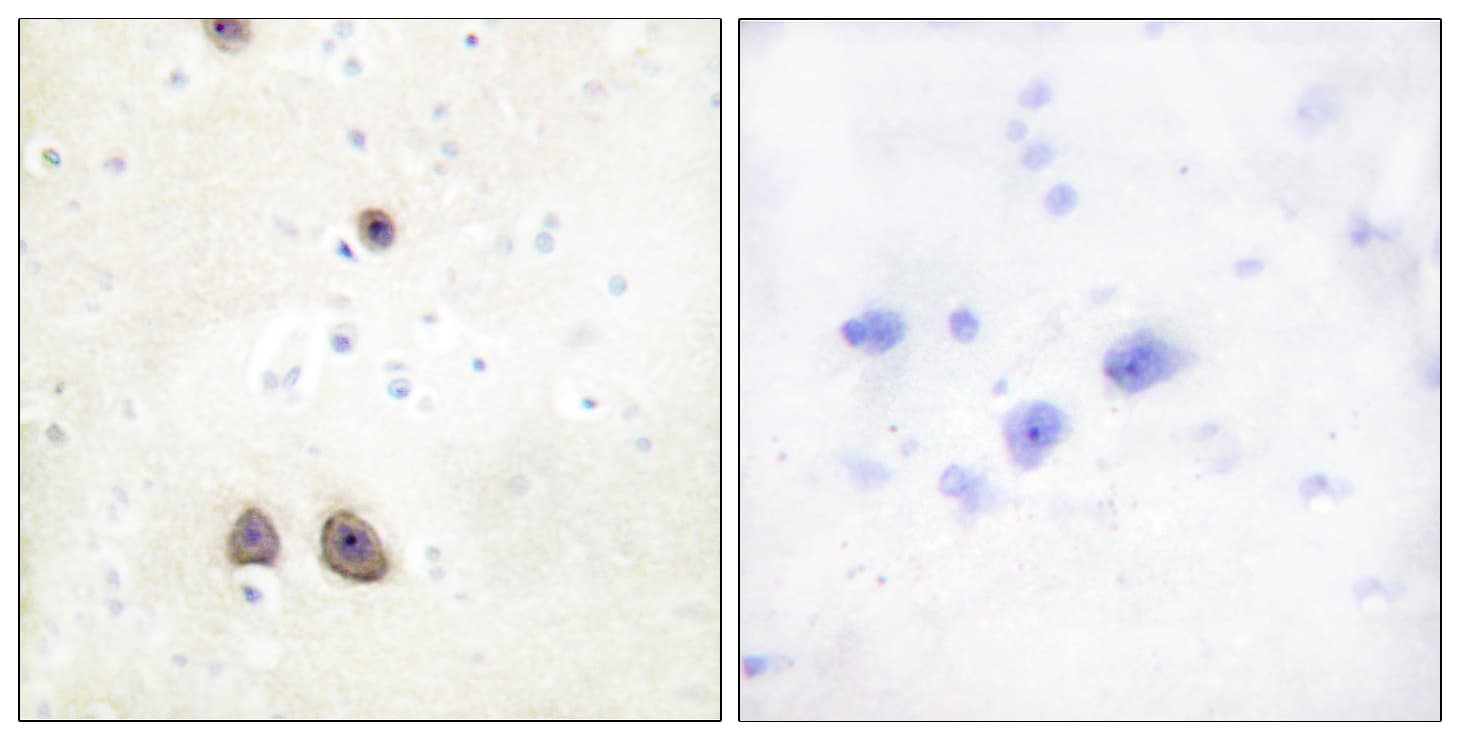 ATP6AP2 / Renin Receptor Antibody (aa171-220)
