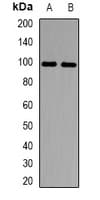 IHC-plus™ Polyclonal Rabbit anti-Human MCM10 Antibody (IHC, IF, WB)