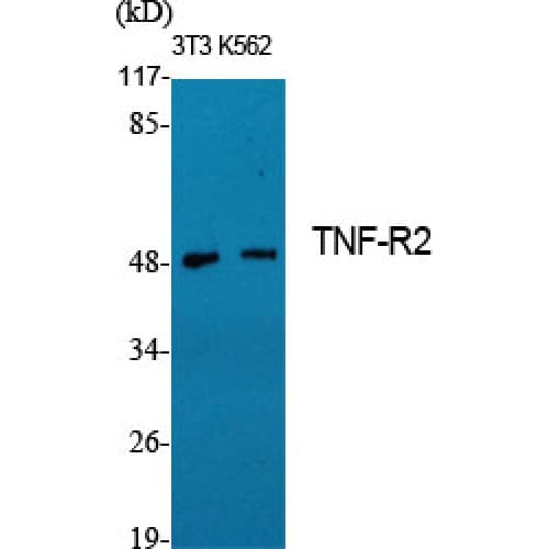 TNFRSF1B / TNFR2 Antibody (350-430 aa, C-terminal)