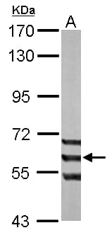ADCK1 Antibody (aa45-213)