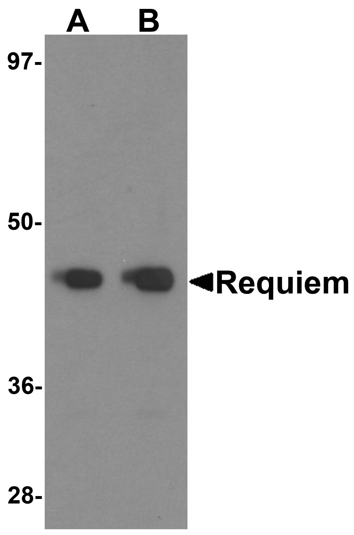 IHC-plus™ Requiem / DPF2 Antibody